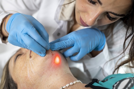 Dr.ssa Viviana Vacanti durante un trattamento di medicina estetica